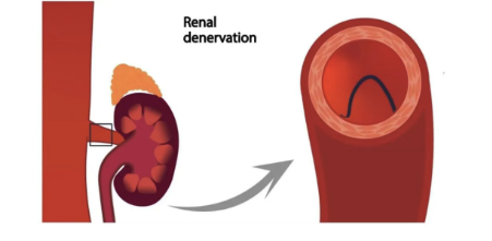 截屏2025-11-10 14.04.06.png
